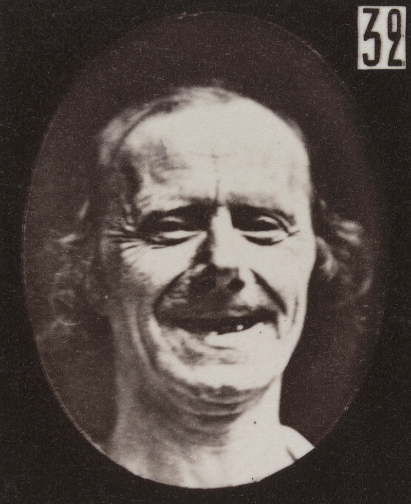 Illustration for article titled Terrifying, Century-Old Photographs from Neuroscience Experiments